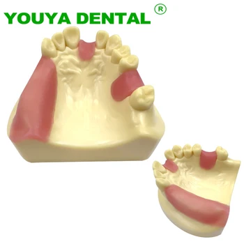 Dantų Implantai Praktikos Modelis Odontologijos Studijų Mokymo Dantų, Žandikaulio Typodont Modelis Stomatologas Švietimo, Mokymo Demonstravimo Priemonių